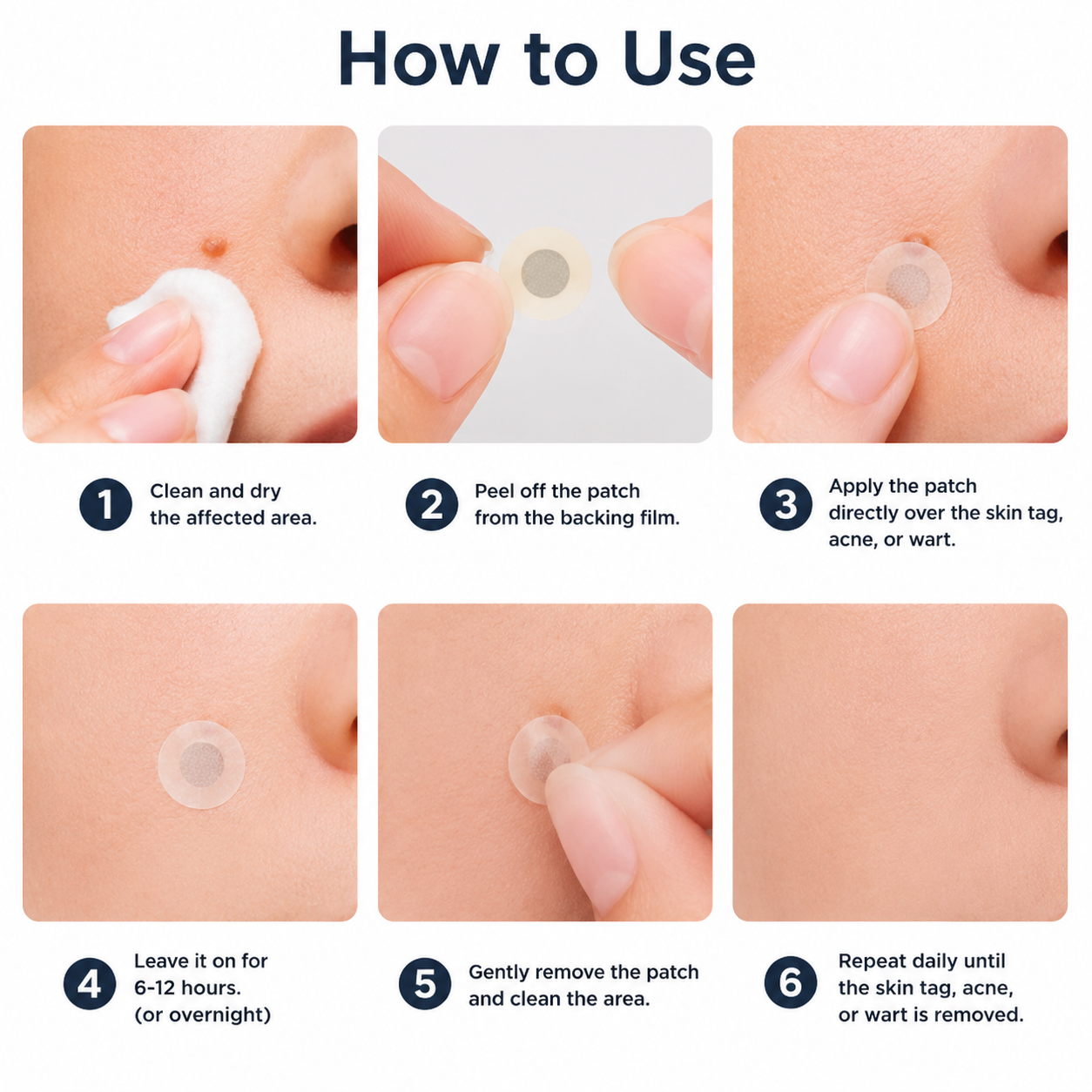 Biancat®2-in-1 Microneedle & Hydrocolloid Patch🍀| Removes Raised Moles, Acne, Flat Warts & Skin Tags | Helps Improve Wrinkles, Scars & Blemishes | Invisible Patches for Face & Body