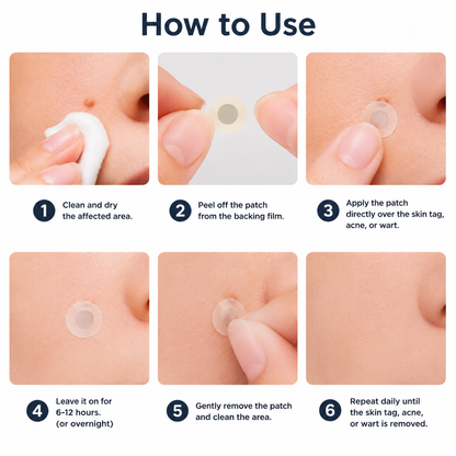 Biancat®2-in-1 Microneedle & Hydrocolloid Patch🍀| Removes Raised Moles, Acne, Flat Warts & Skin Tags | Helps Improve Wrinkles, Scars & Blemishes | Invisible Patches for Face & Body