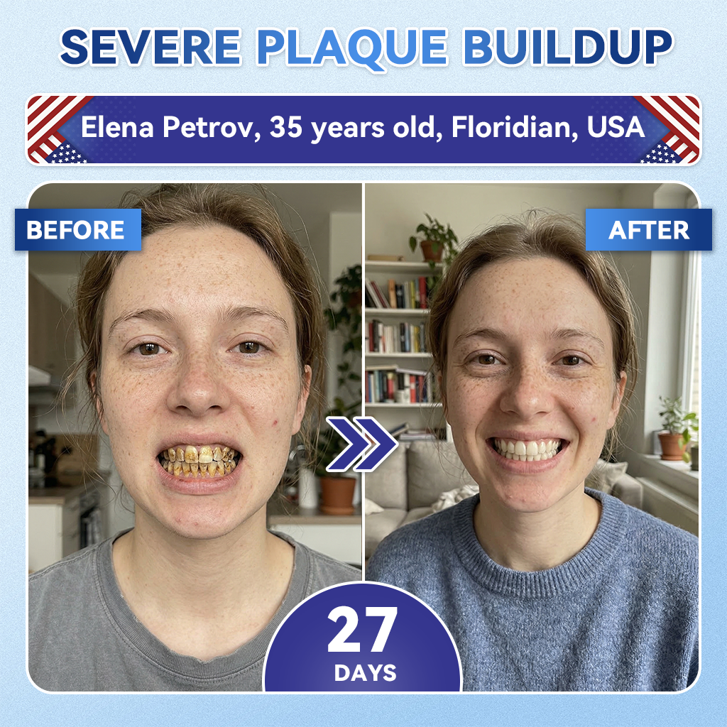 Your Smile~ NESLEMY® 🦷 Tideglusib Fast‑Dissolving Tooth & Gum Repair Oral Strips ✨ (𝟓-𝐢𝐧-𝟏 💎 𝐑𝐞𝐛𝐮𝐢𝐥𝐝 𝐄𝐧𝐚𝐦𝐞𝐥 & 𝐃𝐞𝐧𝐭𝐢𝐧 • 𝐒𝐭𝐫𝐞𝐧𝐠𝐭𝐡𝐞𝐧 𝐆𝐮𝐦𝐬 • 𝐄𝐫𝐚𝐝𝐢𝐜𝐚𝐭𝐞 𝐓𝐚𝐫𝐭𝐚𝐫 & 𝐎𝐝𝐨𝐫 • 𝐖𝐡𝐢𝐭𝐞𝐧𝐢𝐧𝐠 • 𝐒𝐭𝐨𝐩 𝐓𝐨𝐨𝐭𝐡 𝐒𝐞𝐧𝐬𝐢𝐭𝐢𝐯𝐢𝐭𝐲)