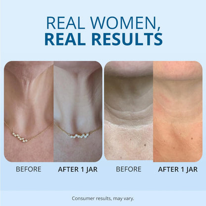 Neck Firming Cream -🔥Up to 70% off🔥🔥[Firming and lifting] [Deep Nourishment and moisturizing] [Reducing Wrinkles