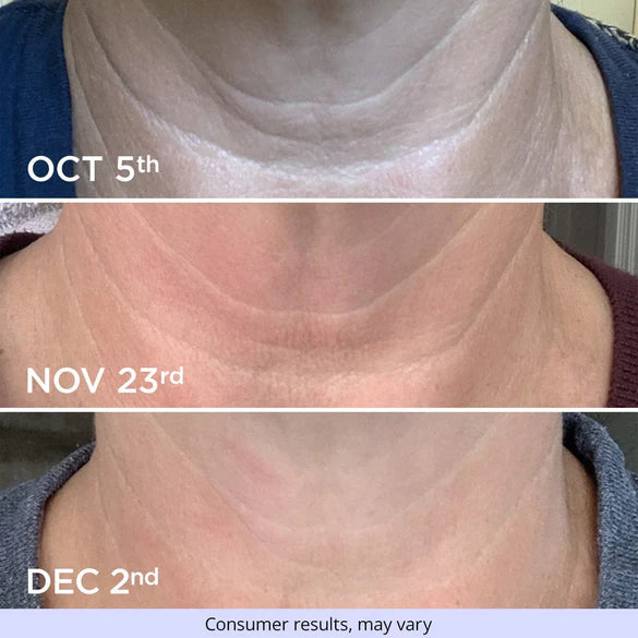 Neck Firming Cream -🔥Up to 70% off🔥🔥[Firming and lifting] [Deep Nourishment and moisturizing] [Reducing Wrinkles