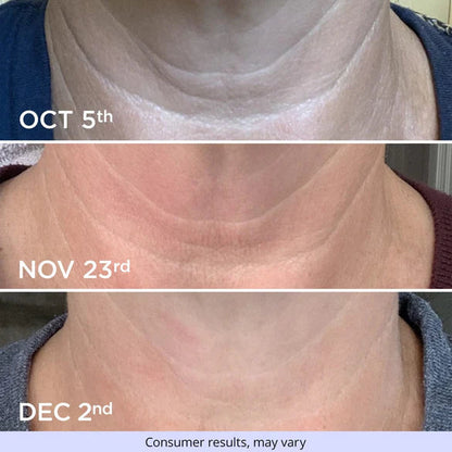 Neck Firming Cream -🔥Up to 70% off🔥🔥[Firming and lifting] [Deep Nourishment and moisturizing] [Reducing Wrinkles