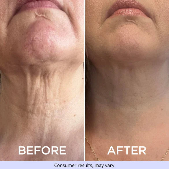 Neck Firming Cream -🔥Up to 70% off🔥🔥[Firming and lifting] [Deep Nourishment and moisturizing] [Reducing Wrinkles